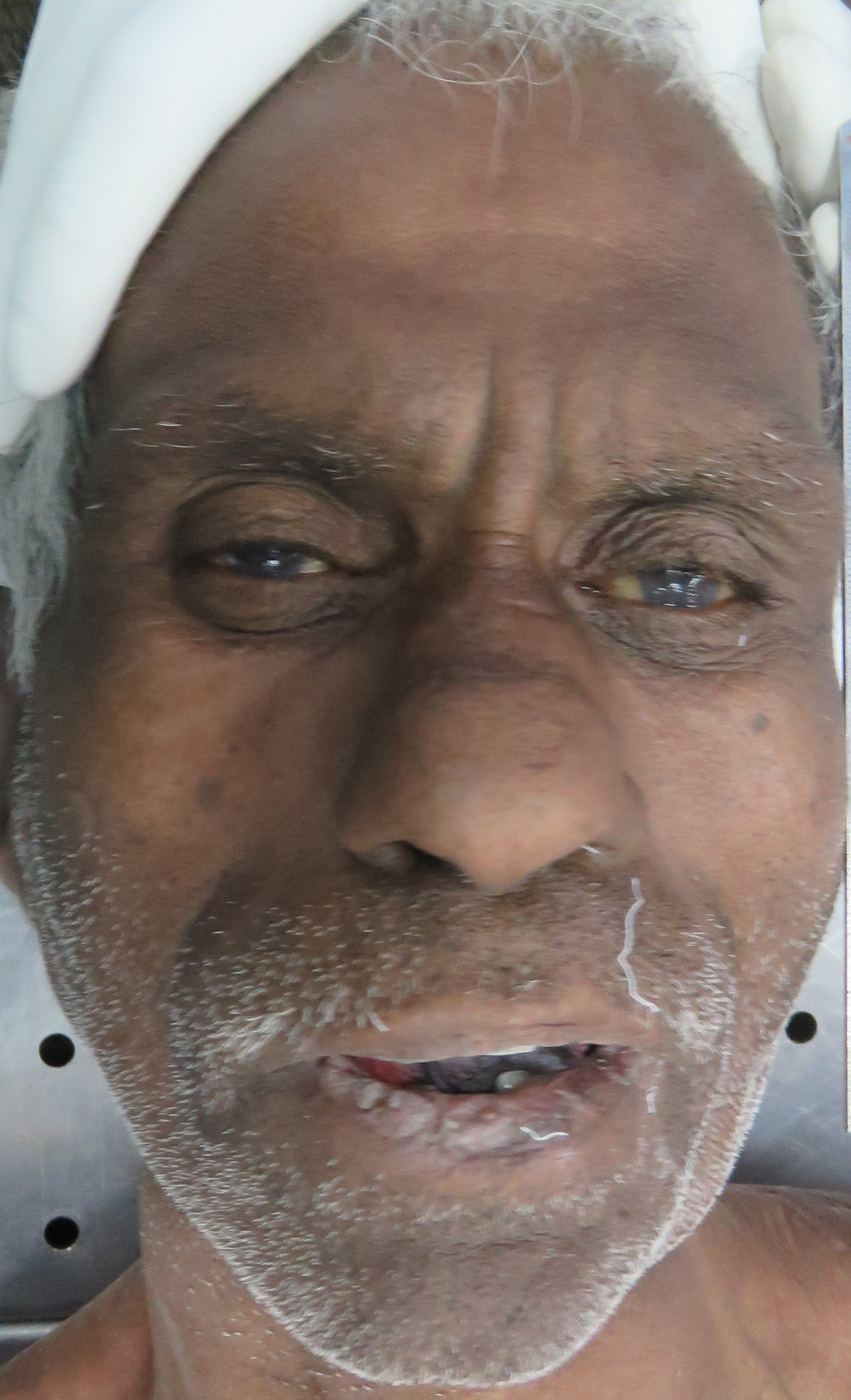 Front Image
